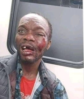 Anambra Bus Preacher Beaten To Coma After Condoms Fall From Bible (Photos)