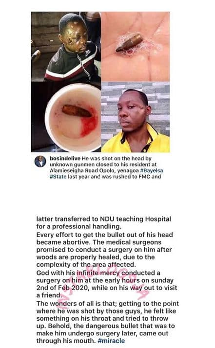 Man Vomits Stray Bullet Stuck In His Skull For Months (Photos)