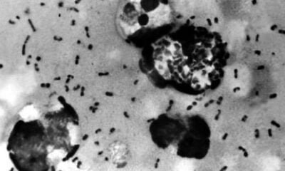 Another Disease 'Bubonic Plague' Breaks Out In China Amid Coronavirus