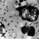 Another Disease 'Bubonic Plague' Breaks Out In China Amid Coronavirus