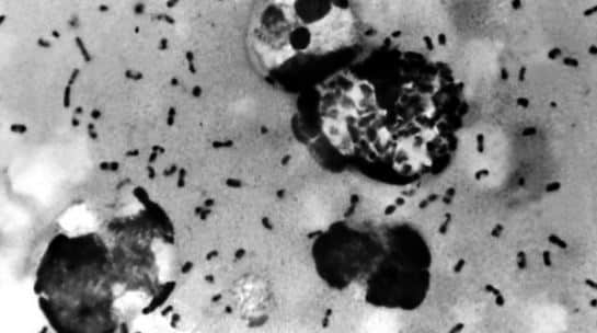 Another Disease 'Bubonic Plague' Breaks Out In China Amid Coronavirus