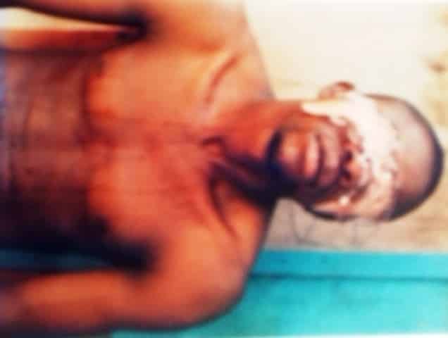 Victim Of Police Brutality Rendered Homeless, Losses Baby (Photos)