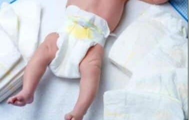 Baby Born With 3 Penises Shocks Doctors