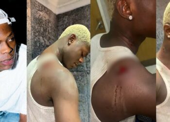 Mohbad Cause of Death: What Killed Mohbad? The Truth is Out